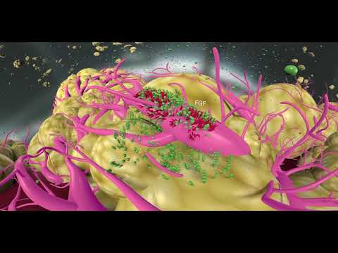 HCC pathophysiology, treatments and mechanisms