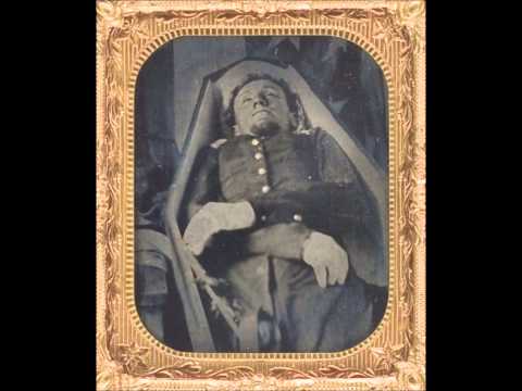 Rare Civil War Postmortem Photographs of Dead Soldiers (1860's)