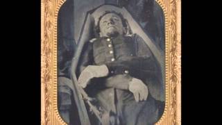 Rare Civil War Postmortem Photographs of Dead Soldiers (1860's)