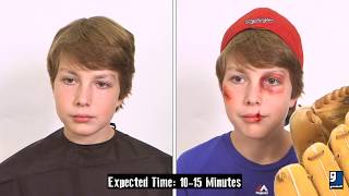 Makeup Tutorial: Athletic Injuries