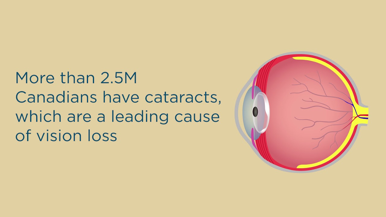 Eye Care At Every Age: Golden Years | Can Macular Degeneration Be Treated?