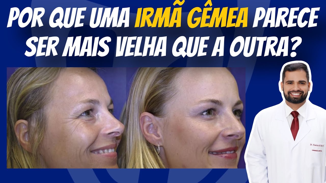 Francisco De Assis Almeida Lima Júnior-91