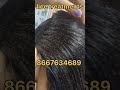 Lice Treatments In Chennai Appointment Available Contact 8667634689 Shorts Ytshorts