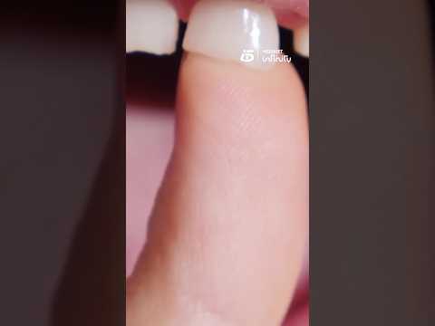 Los dientes de leche podrían ayudar frente a enfermedades neurodegenerativas gracias a sus células