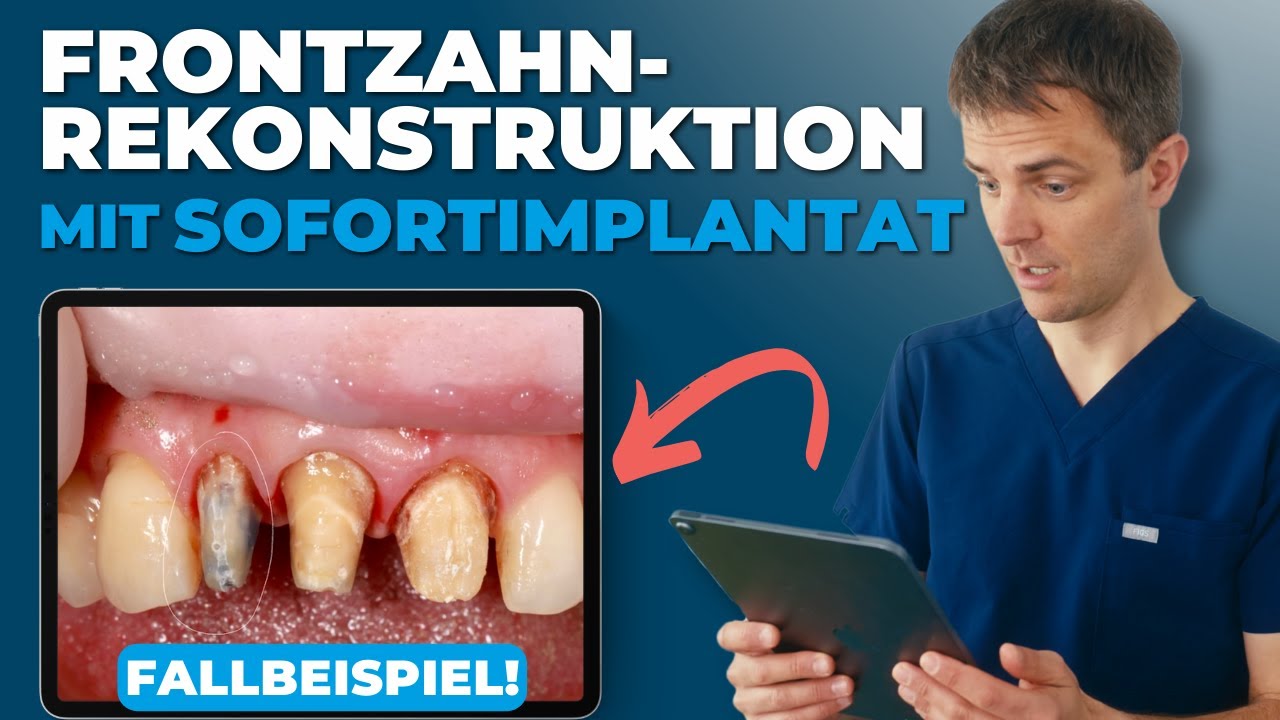 Video-Vorschaubild