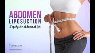 Abdomen Liposuction in Korea-2018