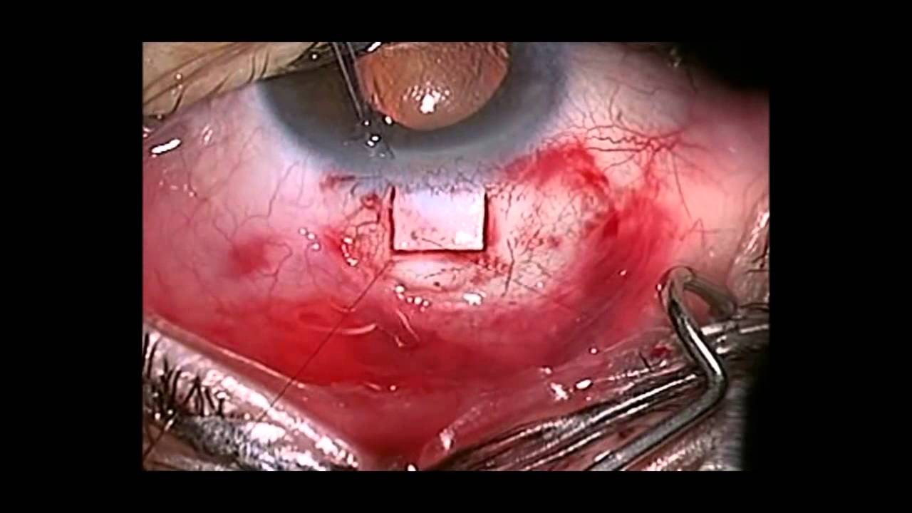 Axel De Jesus Jarillo Figueroa-13