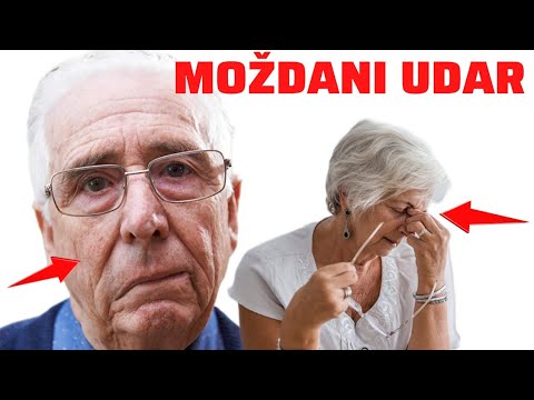 Simptomi MOŽDANOG UDARA koje IGNORIRATE! Ovo Vam može SPASITI ŽIVOT...