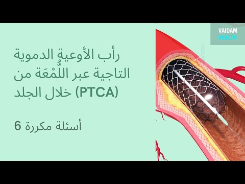 الأسئلة المتداولة حول رأب الأوعية التاجية عن طريق الجلد