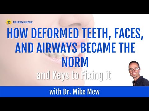 ☀️ How to fix Deformed Teeth, Faces & Airways (2024)