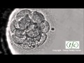 Human Embryo Growing from Fertilization to Day 6 Blastocyst