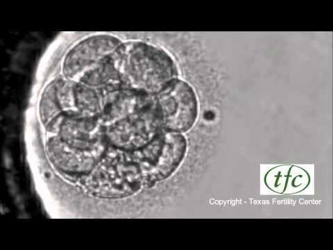 Human Embryo Growing from Fertilization to Day 6 Blastocyst