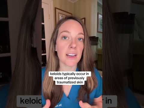 How to Prevent a Keloid #scar