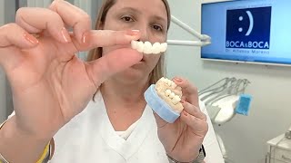 ✔️ ¿Cuál es la diferencia entre corona y carilla dental Clínicas dentales Boca&Boca Málaga ✔️