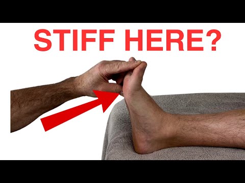 Metatarsalgia and Morton s Neuroma Evaluation and Treatment