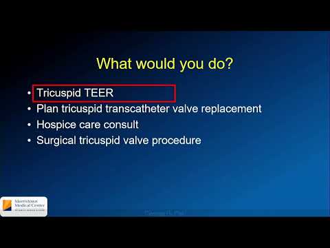 Ss 6 Complex Case Collaborative Approach to Managing Severe Tricuspid Regurgitation Freemedbooks.com