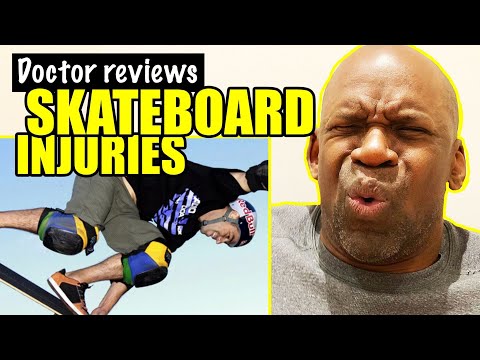 SKATEBOARDING INJURIES | DOCTOR REVIEWS SKATEBOARD FAILS WITH BROKEN BONES | DR. CHRIS Video