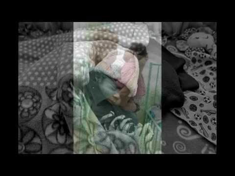 Rescue a Malnourished Child in Guatemala