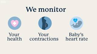 Induction of Labor: What to Expect | UCLA Health BirthPlace