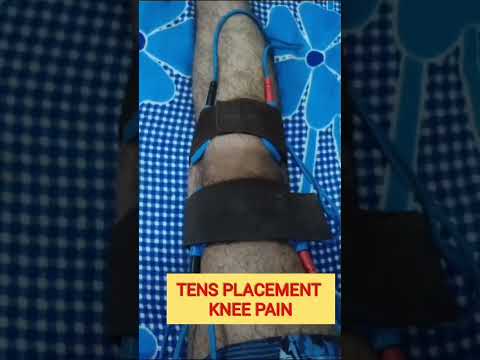 TENS PAD PLACEMENT FOR KNEE JOINT !! @physioyears