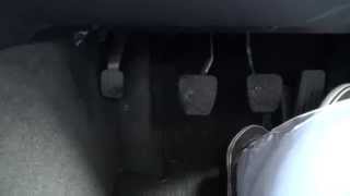 HILL START ASSIST and the HOLD feature on a Mercedes Benz with foot operated parking brake.