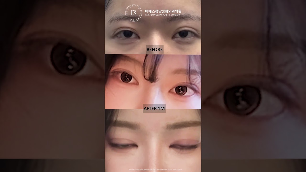 이에스 유튜브