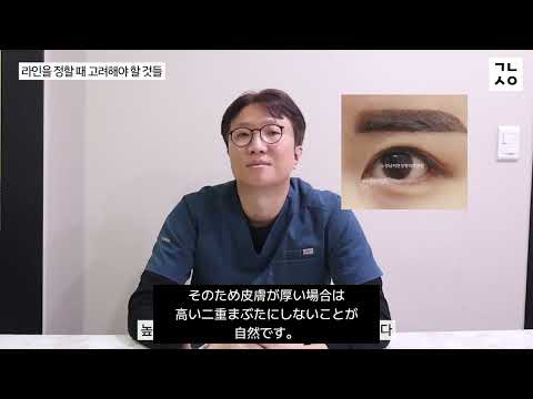 二重まぶた初めての手術 PART2 自分に合うラインの決め方