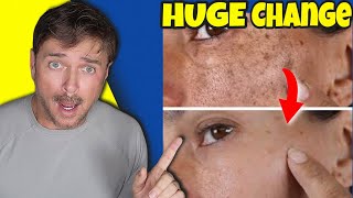The Secret Oil for Younger Looking Skin Revealed!