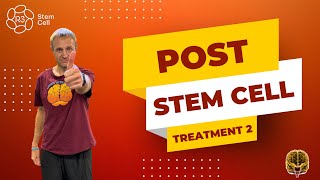 Post Stem Cell Treatment — Results & Recovery
