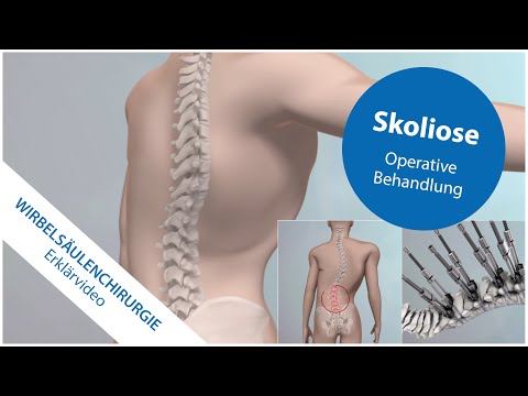 Download der Diagnose und Behandlung von Gelenken Wunder Hals und Rücken zwischen den Schulterblättern, warum
