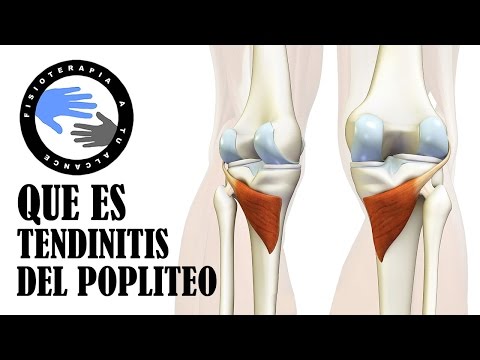 Bad ora articolazioni Mal di collo quando