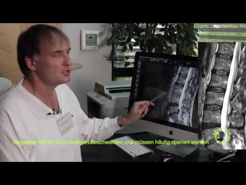 Bandscheibenvorfall, Rückenschmerzen, Hexenschuß erklärt vom Facharzt am MRT (Kernspintomografie)