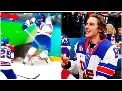 USA star Jack Hughes loses teeth after high stick from Canada Olympic hockey 2026