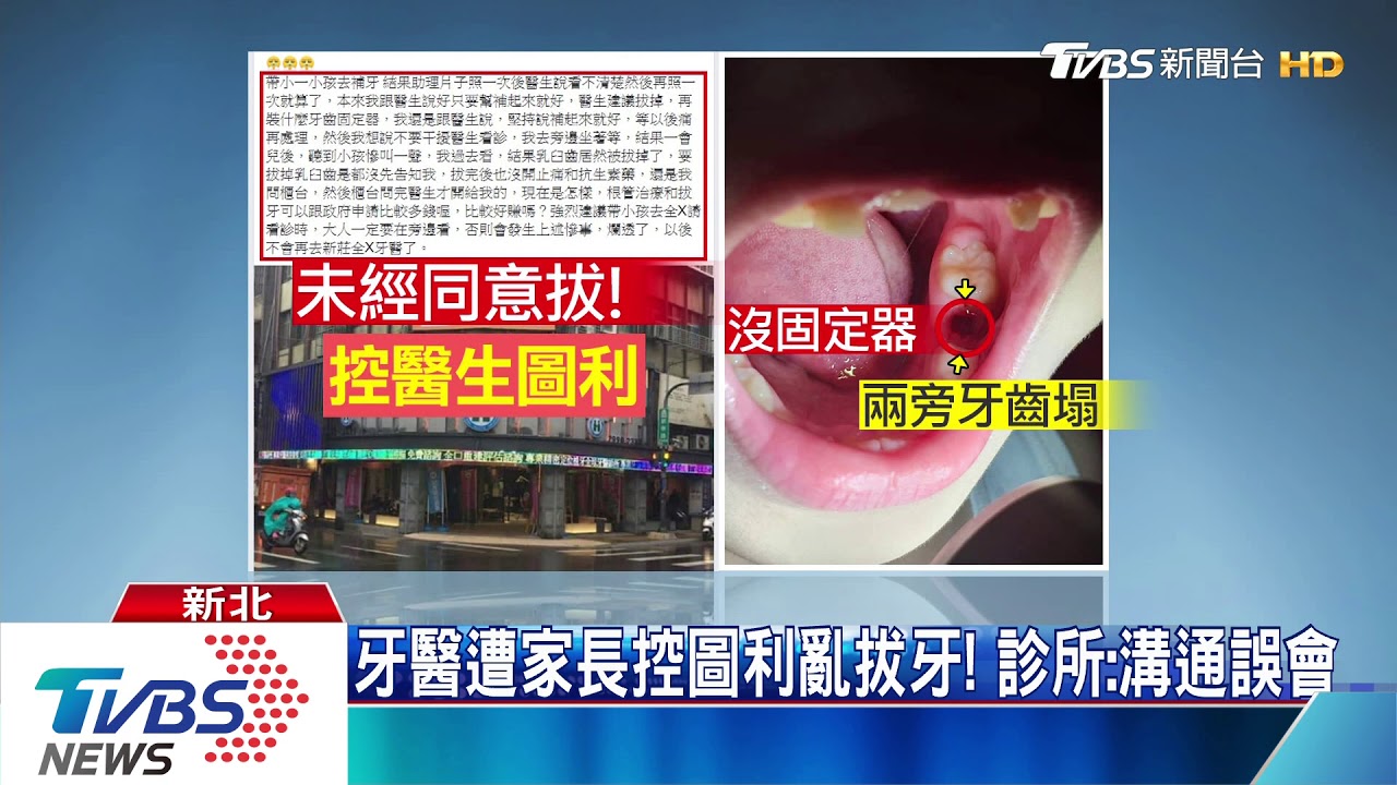 家長控醫未經同意亂拔牙! 診所:溝通誤會