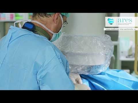 Centrele de Excelenta ARES | Dr. Ion Bostan - Despre stimulatorul cardiac | About pacemaker