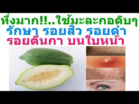 กลากจุลินทรีย์ในภาพถ่ายเด็ก สาเหตุโรคสะเก็ดเงินโรค