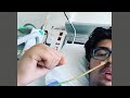 Sehraz (16) wakker na 10 dagen op intensive care door corona