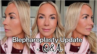 Upper Blepharoplasty Update and Q&A (2 months Before & After) Emily Norris