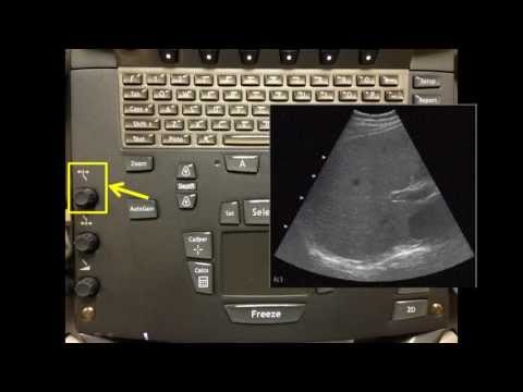download lagu mp3 mp4 How To Operate Ultrasound Machine, download lagu How To Operate Ultrasound Machine gratis, unduh video klip How To Operate Ultrasound Machine