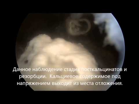 Возможна ли беременность если болит спина Острая боль спины во время сна