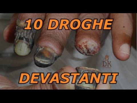 Si può ottenere da un uomo la cui prostata Quali farmaci il più bene nel trattamento della prostatite