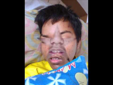 Isang anti-fungal paa at kuko Lunas na halamang-singaw orungal