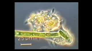 Amoeba eating a green algae
