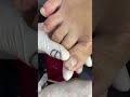 Lấy Khoé Chân Sâu XUYÊN NAIL CÀ MAU Tập 428 Nails Nails Nailvideos Naildesigns