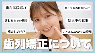 【歯列矯正】リアルにかかった費用・期間・痛み・歯科医院選びなど！よく質問いただく内容に全部答えました🦷【今井美桜】