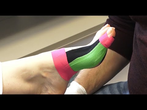 Podo Taping Concept© Hallux rigidus Gelenkschmerzen (Arthrose der Großen Zehe)
