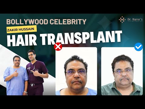 Before & After Transformation