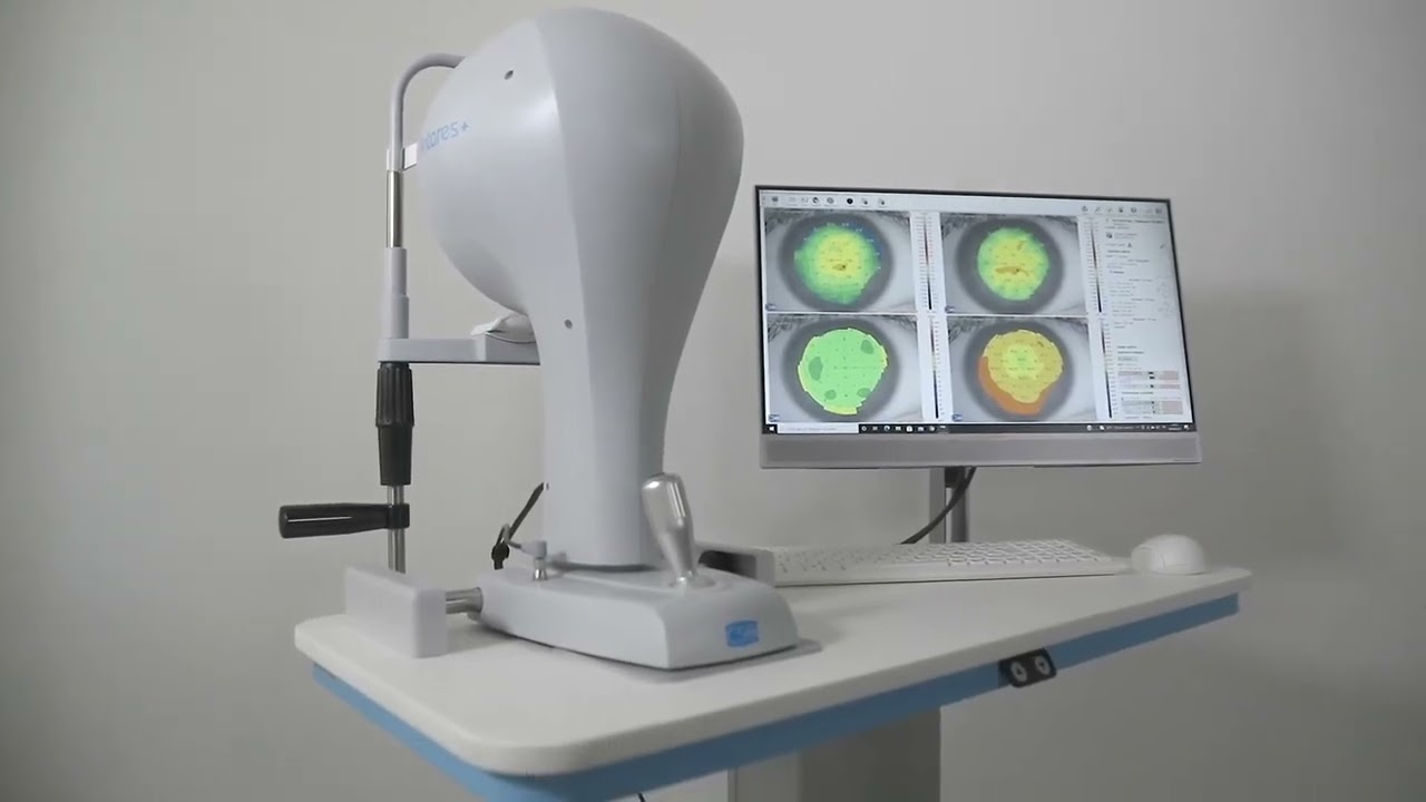 Antares+ Corneal Topographer — סרטון