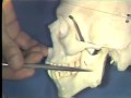 Nerve Supply to Teeth; Maxillary Sinus