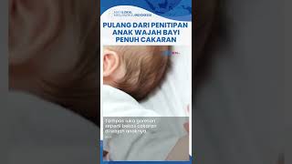 Miris! Jemput Bayi di Penitipan Anak Berujung Pilu, Ibu Syok Wajah Anaknya Penuh Luka Cakaran